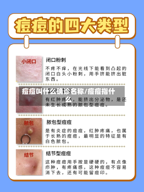 痘痘叫什么确诊名称/痘痘指什么
