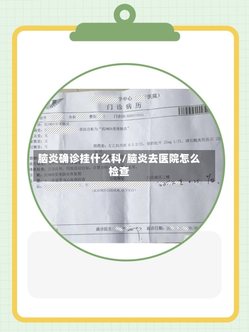 脑炎确诊挂什么科/脑炎去医院怎么检查