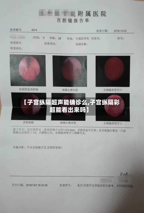 【子宫纵隔超声能确诊么,子宫纵隔彩超能看出来吗】