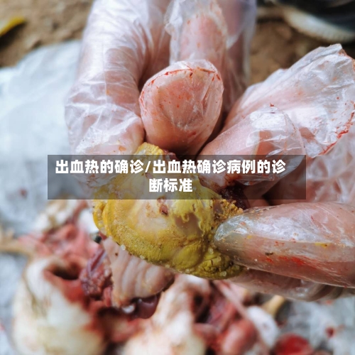 出血热的确诊/出血热确诊病例的诊断标准