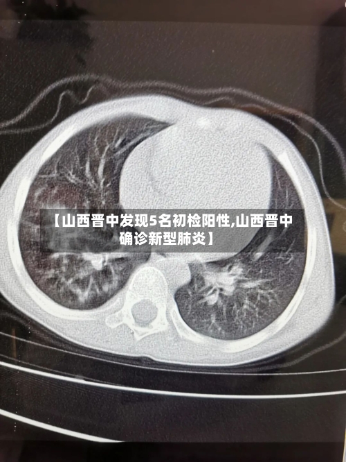 【山西晋中发现5名初检阳性,山西晋中确诊新型肺炎】