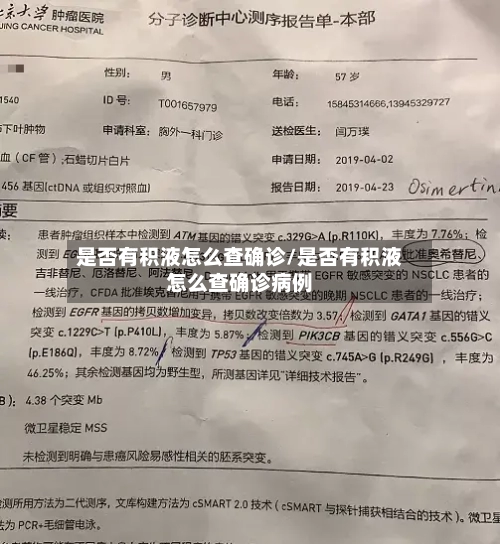 是否有积液怎么查确诊/是否有积液怎么查确诊病例