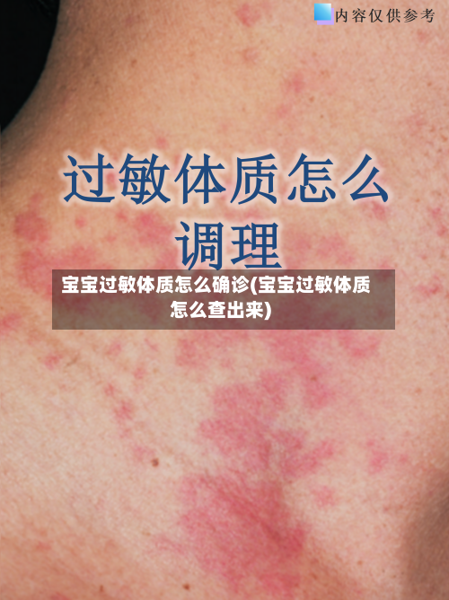 宝宝过敏体质怎么确诊(宝宝过敏体质怎么查出来)