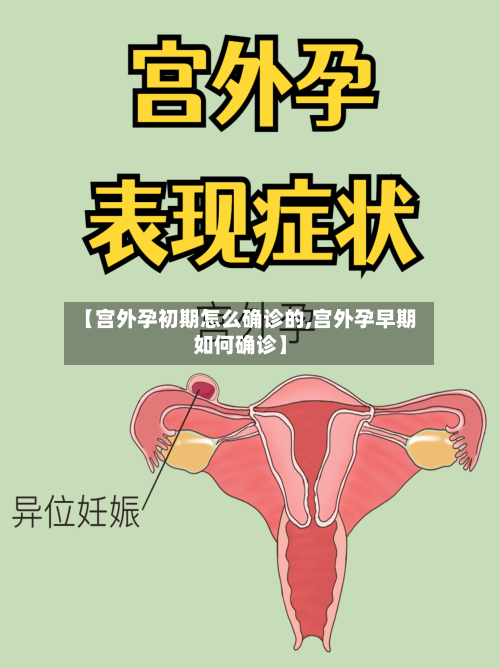 【宫外孕初期怎么确诊的,宫外孕早期如何确诊】