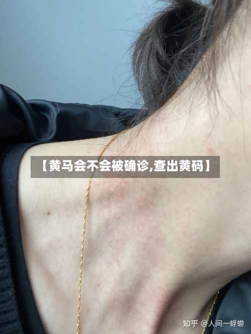 【黄马会不会被确诊,查出黄码】