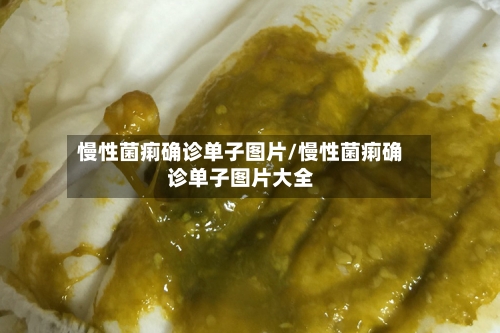 慢性菌痢确诊单子图片/慢性菌痢确诊单子图片大全