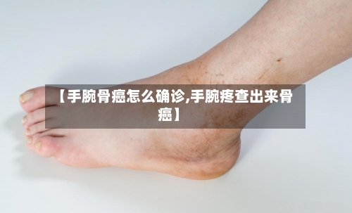 【手腕骨癌怎么确诊,手腕疼查出来骨癌】