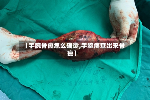 【手腕骨癌怎么确诊,手腕疼查出来骨癌】