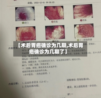 【术后胃癌确诊为几期,术后胃癌确诊为几期了】