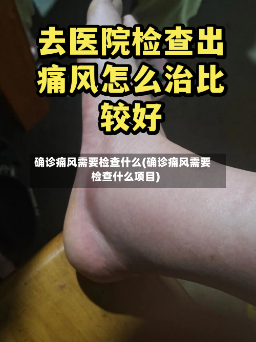 确诊痛风需要检查什么(确诊痛风需要检查什么项目)