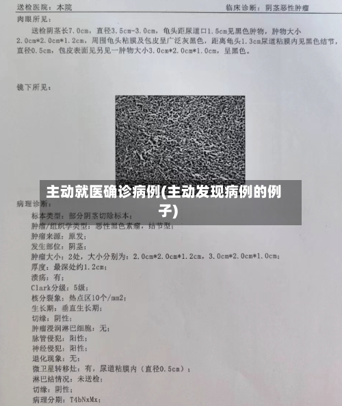 主动就医确诊病例(主动发现病例的例子)