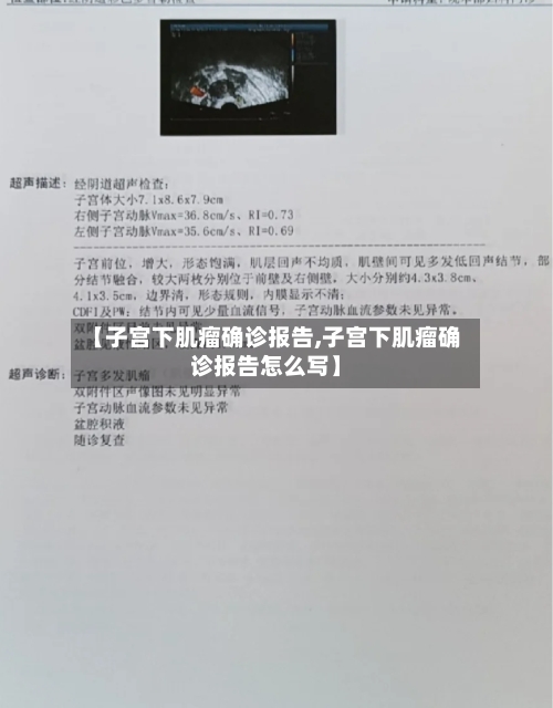 【子宫下肌瘤确诊报告,子宫下肌瘤确诊报告怎么写】