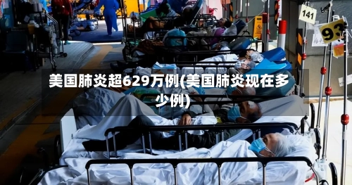 美国肺炎超629万例(美国肺炎现在多少例)