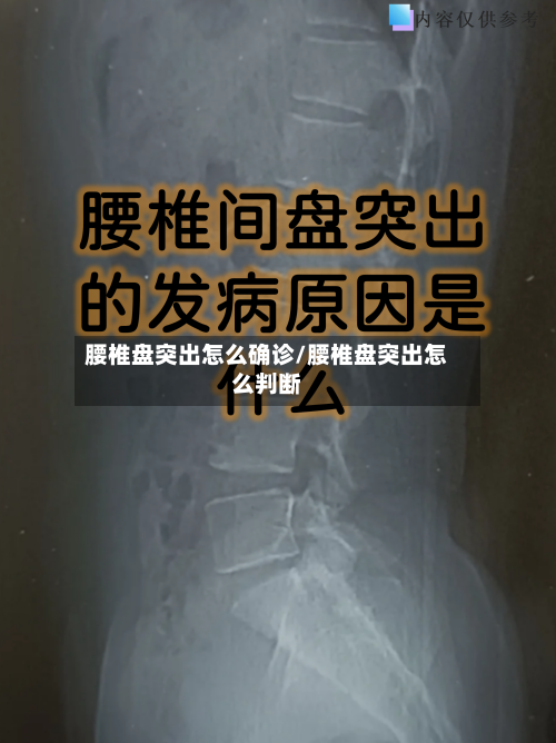 腰椎盘突出怎么确诊/腰椎盘突出怎么判断