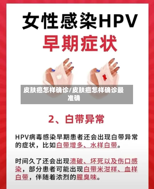 皮肤癌怎样确诊/皮肤癌怎样确诊最准确