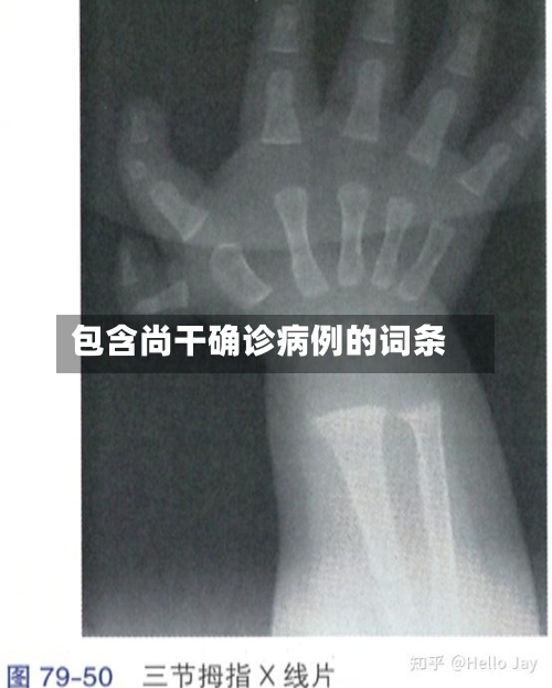 包含尚干确诊病例的词条