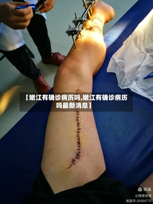 【嫩江有确诊病历吗,嫩江有确诊病历吗最新消息】