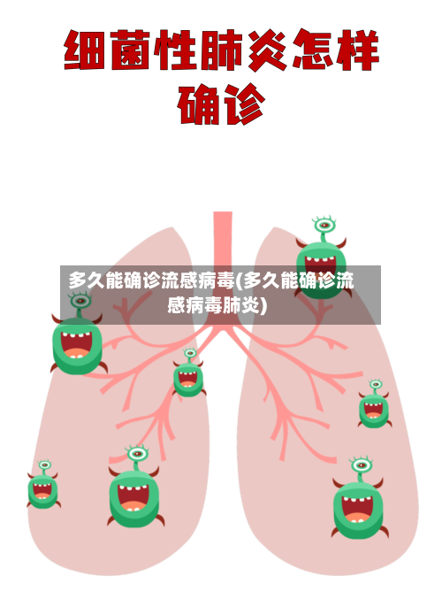 多久能确诊流感病毒(多久能确诊流感病毒肺炎)