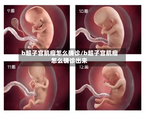 b超子宫肌瘤怎么确诊/b超子宫肌瘤怎么确诊出来