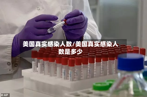 美国真实感染人数/美国真实感染人数是多少