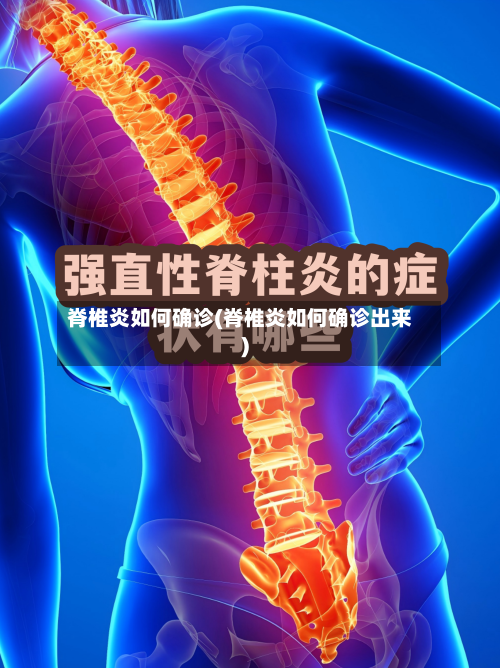 脊椎炎如何确诊(脊椎炎如何确诊出来)