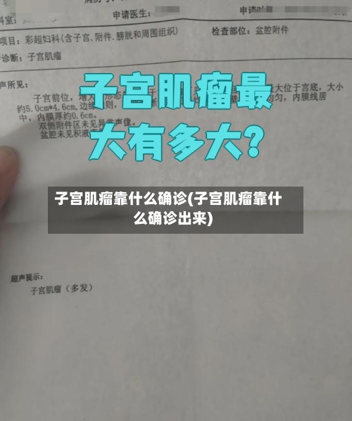 子宫肌瘤靠什么确诊(子宫肌瘤靠什么确诊出来)