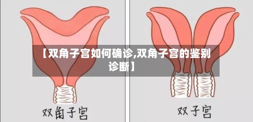 【双角子宫如何确诊,双角子宫的鉴别诊断】
