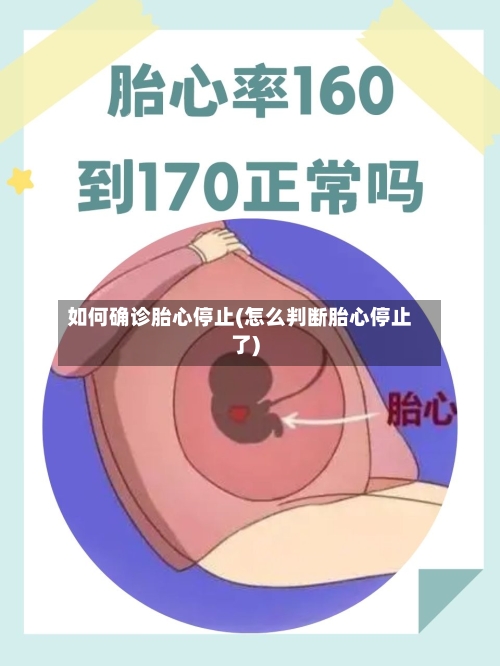 如何确诊胎心停止(怎么判断胎心停止了)