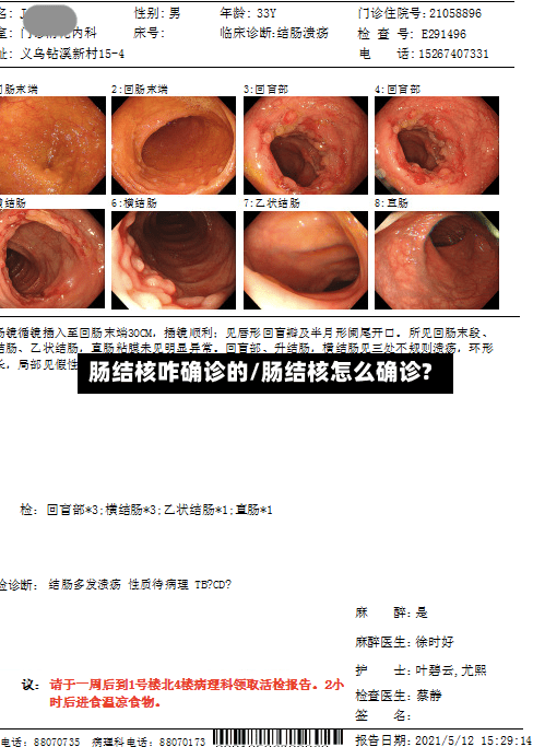 肠结核咋确诊的/肠结核怎么确诊?