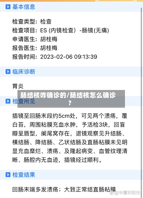 肠结核咋确诊的/肠结核怎么确诊?