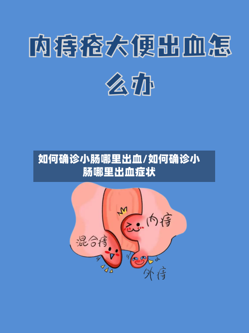 如何确诊小肠哪里出血/如何确诊小肠哪里出血症状