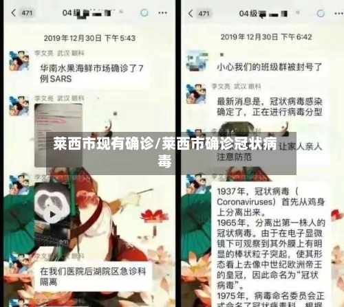 莱西市现有确诊/莱西市确诊冠状病毒