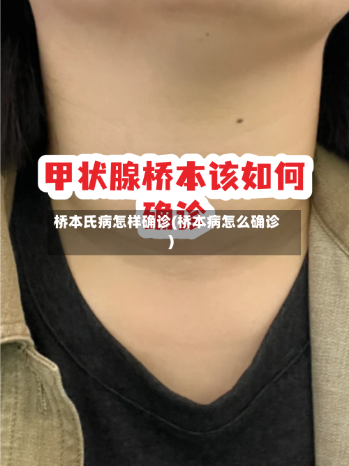 桥本氏病怎样确诊(桥本病怎么确诊)