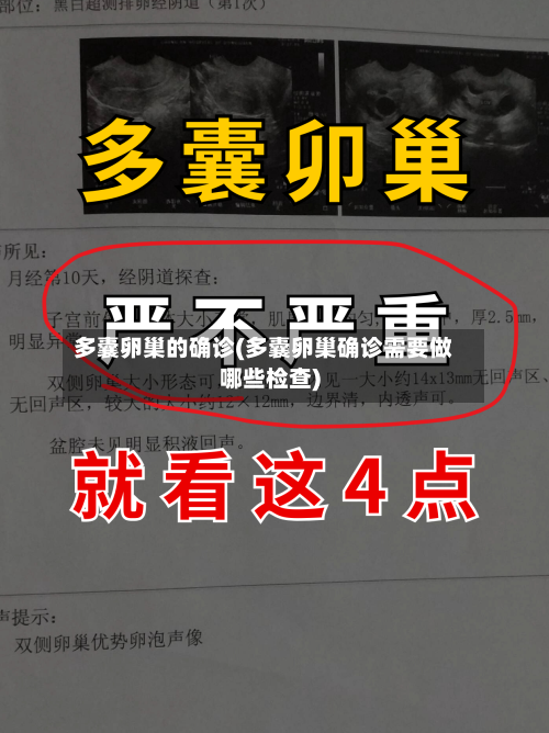 多囊卵巢的确诊(多囊卵巢确诊需要做哪些检查)