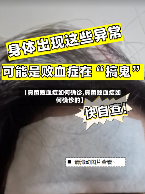 【真菌败血症如何确诊,真菌败血症如何确诊的】