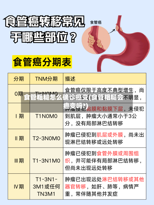 食管粗糙怎么确诊癌变(食管粗糙会癌变吗?)