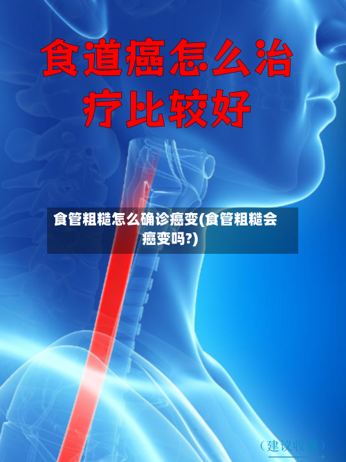食管粗糙怎么确诊癌变(食管粗糙会癌变吗?)