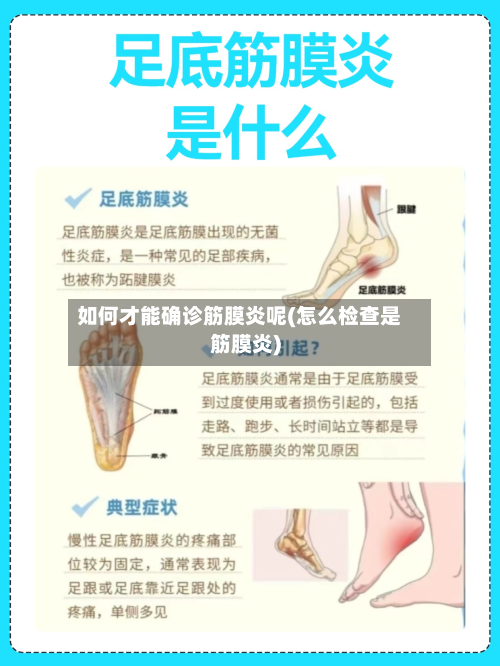 如何才能确诊筋膜炎呢(怎么检查是筋膜炎)