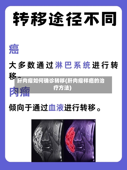 肝肉瘤如何确诊转移(肝肉瘤样癌的治疗方法)