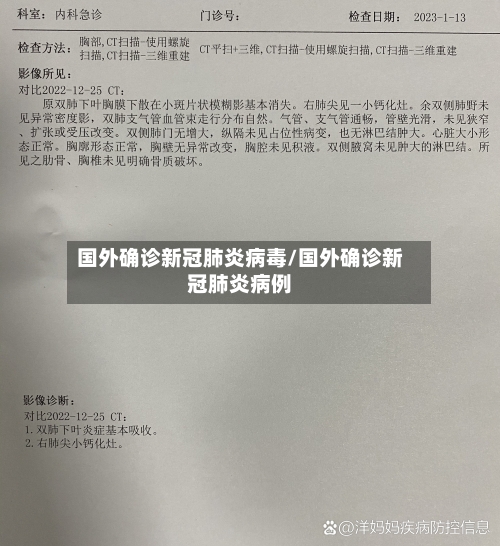 国外确诊新冠肺炎病毒/国外确诊新冠肺炎病例