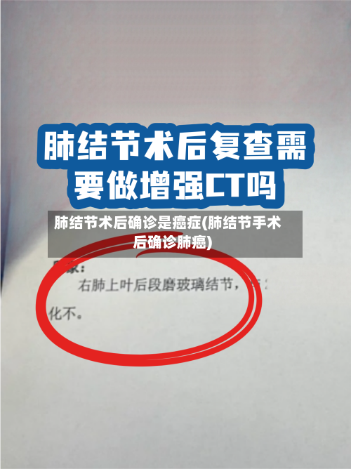 肺结节术后确诊是癌症(肺结节手术后确诊肺癌)