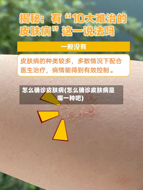 怎么确诊皮肤病(怎么确诊皮肤病是哪一种吧)