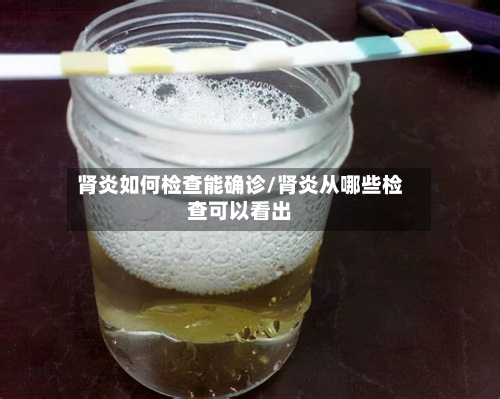 肾炎如何检查能确诊/肾炎从哪些检查可以看出
