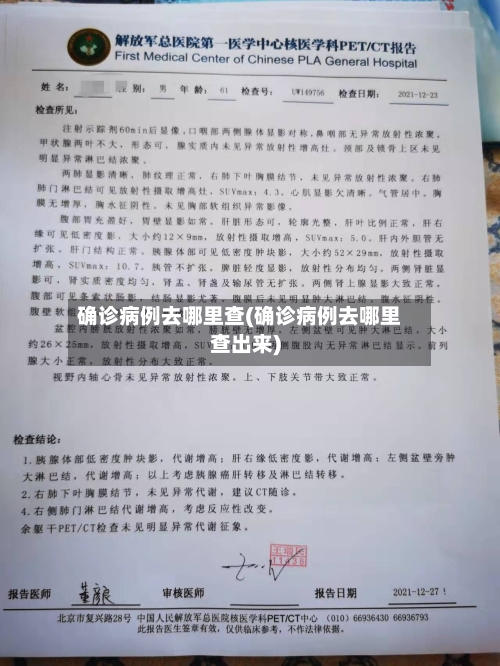 确诊病例去哪里查(确诊病例去哪里查出来)