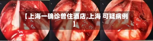 【上海一确诊曾住酒店,上海 可疑病例】