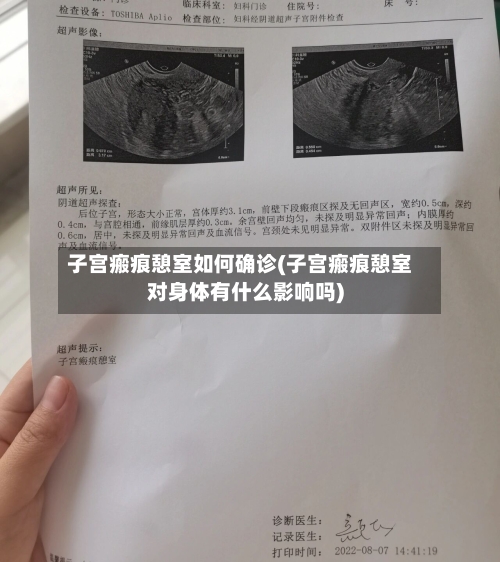 子宫瘢痕憩室如何确诊(子宫瘢痕憩室对身体有什么影响吗)