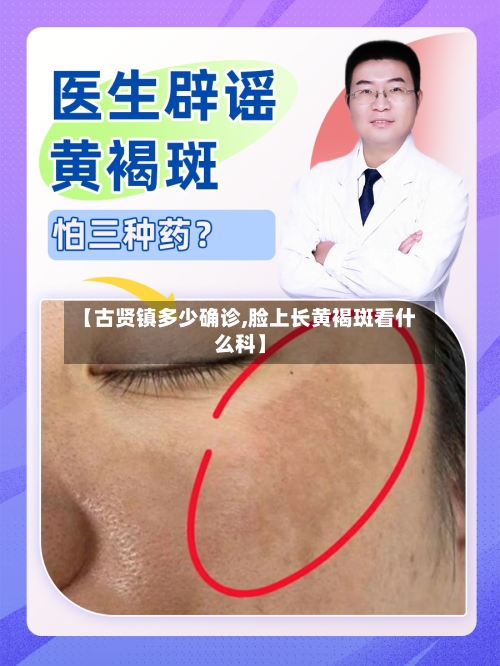 【古贤镇多少确诊,脸上长黄褐斑看什么科】