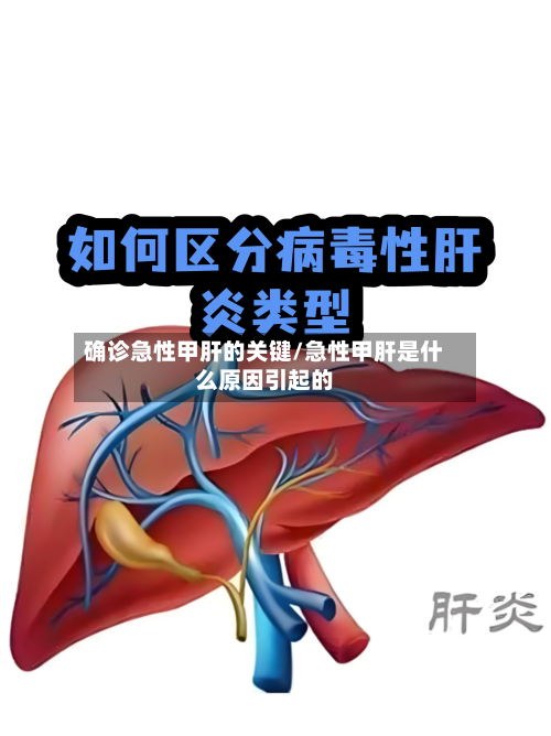 确诊急性甲肝的关键/急性甲肝是什么原因引起的