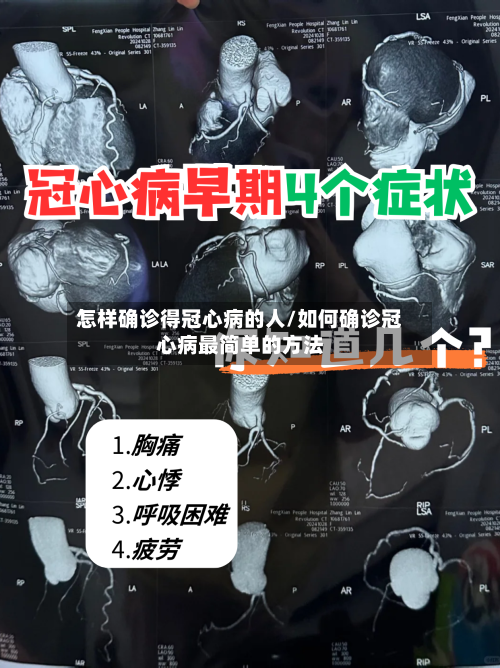 怎样确诊得冠心病的人/如何确诊冠心病最简单的方法