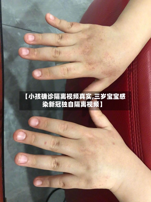 【小孩确诊隔离视频真实,三岁宝宝感染新冠独自隔离视频】